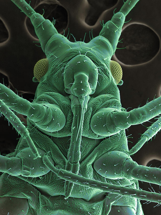Nature Digital Art - High Vacuum Sem Image Of A Plant Lice #1 by M. Suchea And I.v. Tudose