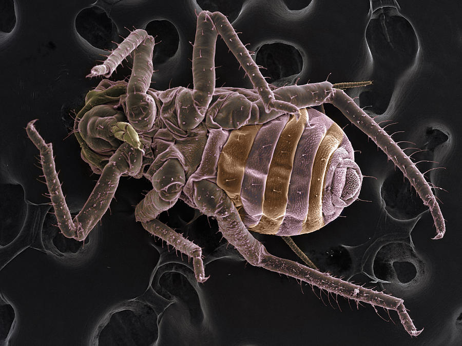 Nature Digital Art - High Vacuum Sem Image Of Plant Lice #1 by M. Suchea And I.v. Tudose