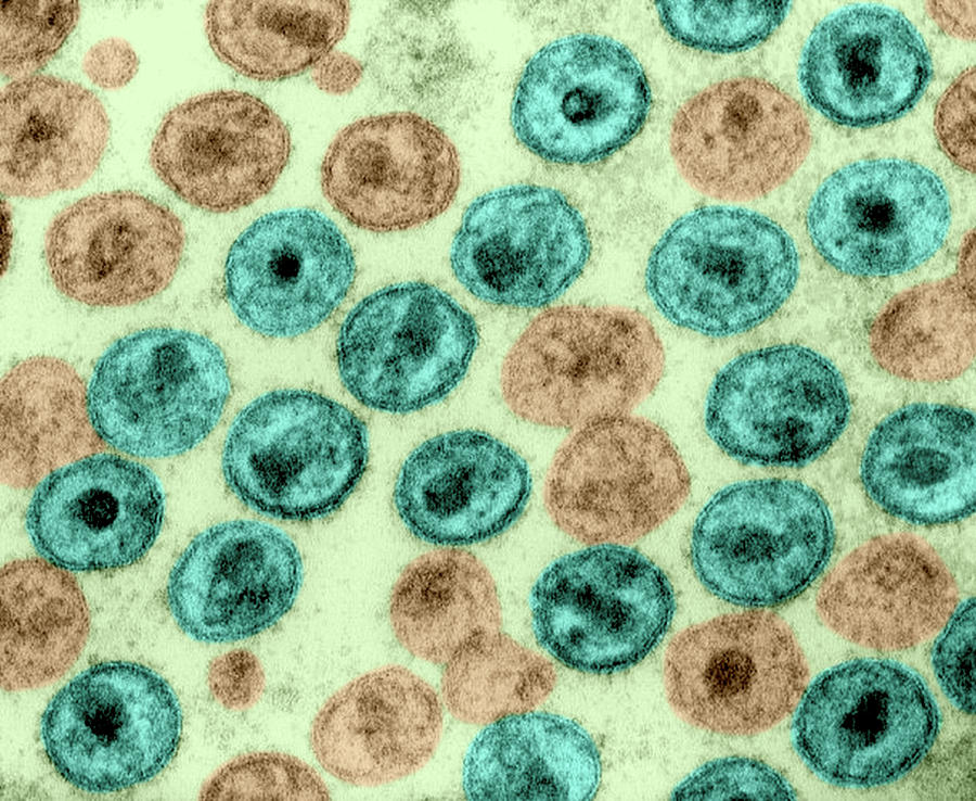 Hiv-1, Human Immunodeficiency Virus, Tem #1 Photograph by Science Source
