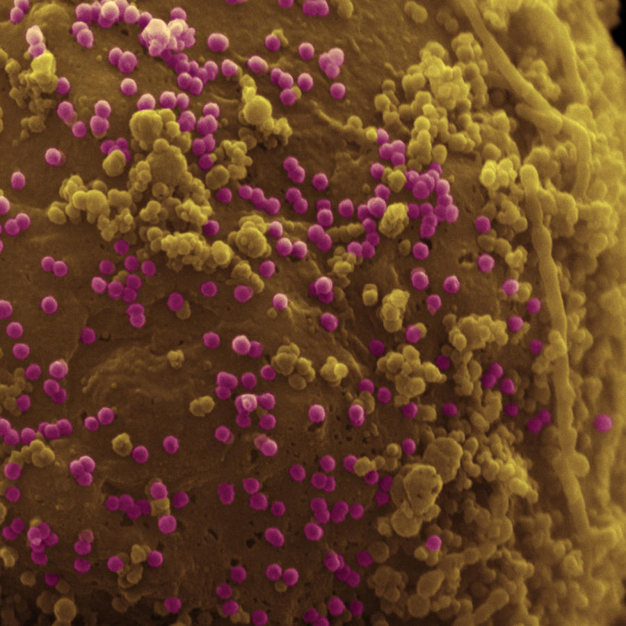 Hiv Viruses And Lymphocytes #1 Photograph by Meckes/ottawa