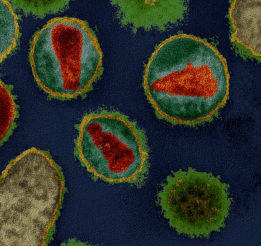 Hiv Viruses #1 Photograph by Meckes/ottawa