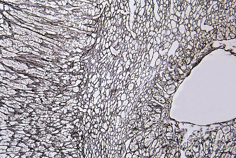 Human Adrenal Gland Cortex And Medulla Photograph by Jose Calvo ... Biology Diagrams