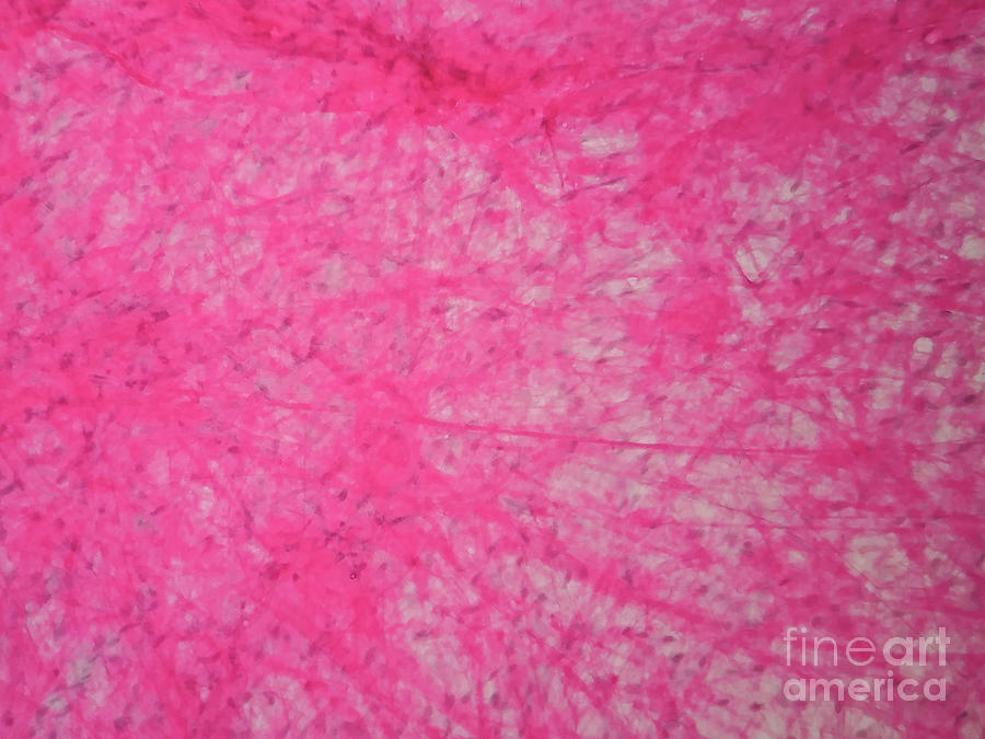 Human Areolar Tissue #1 Photograph by Choksawatdikorn / Science Photo Library