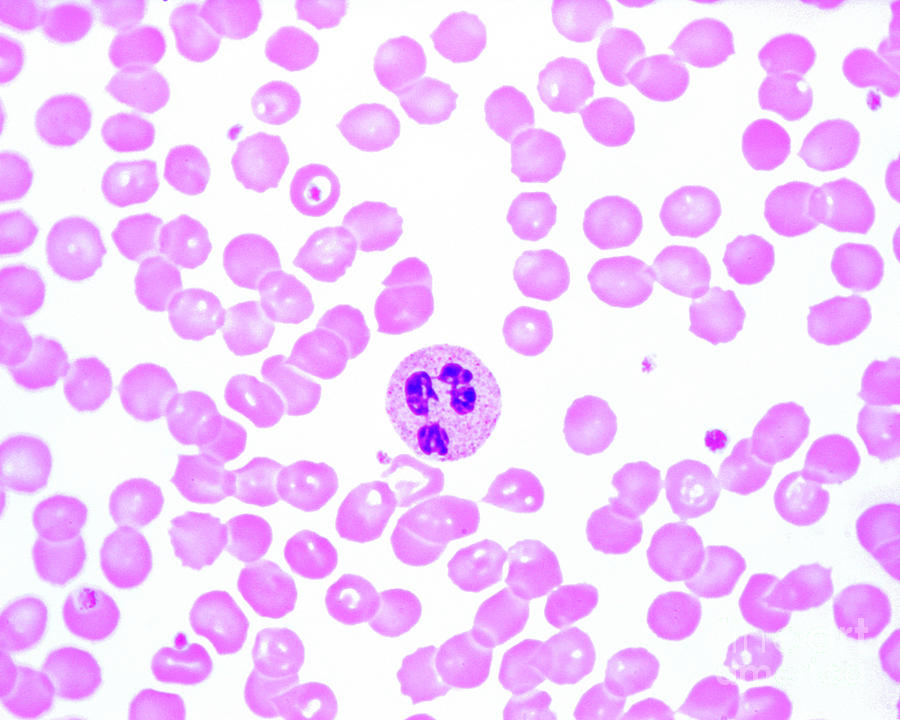 Human Blood Smear With Neutrophil Photograph by Jose Calvo / Science ...