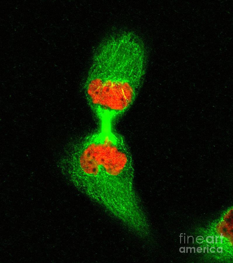 Human Cell In Telophase #1 Photograph by Dr Matthew Daniels/science ...