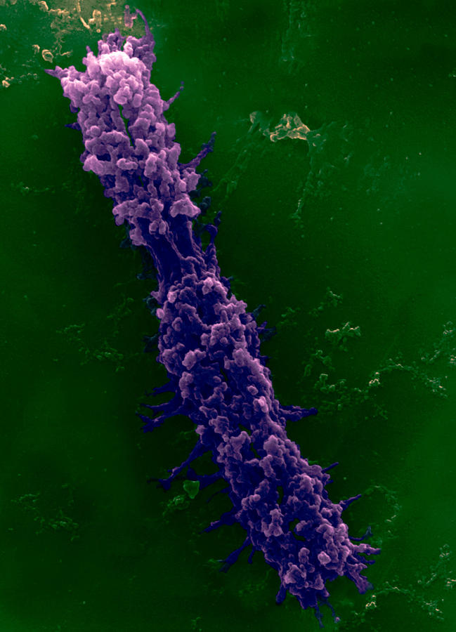 Human Chromosome #1 Photograph by Meckes/ottawa