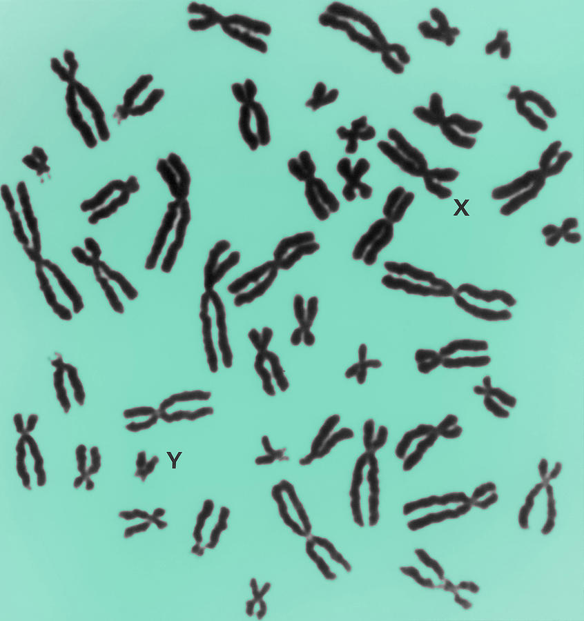 Human Chromosomes #1 Photograph by Biophoto Associates