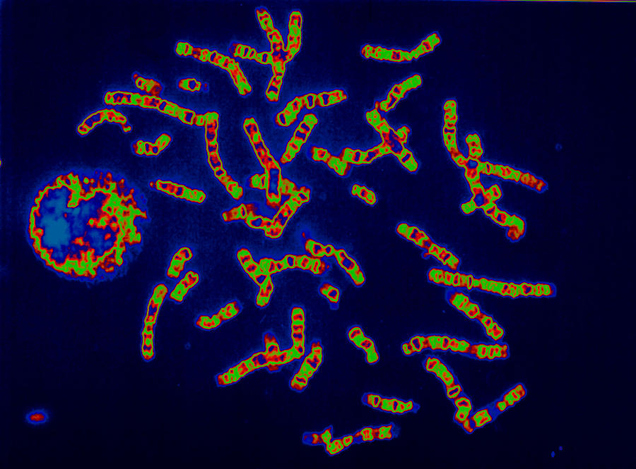 Human Chromosomes #1 Photograph by Meckes/ottawa