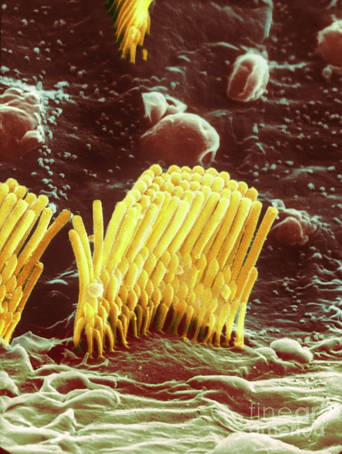 Human Ear Hair Cell #1 Photograph by Professor Tony Wright, Institute Of Laryngology & Otology/science Photo Library
