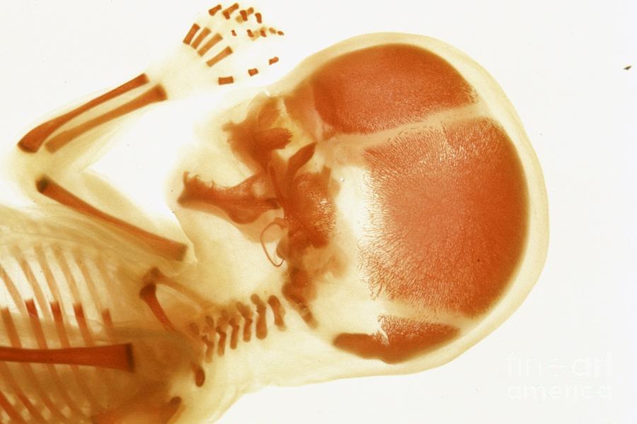 Human Embryo #1 Photograph by Carolina Biological Supply Company/science Photo Library