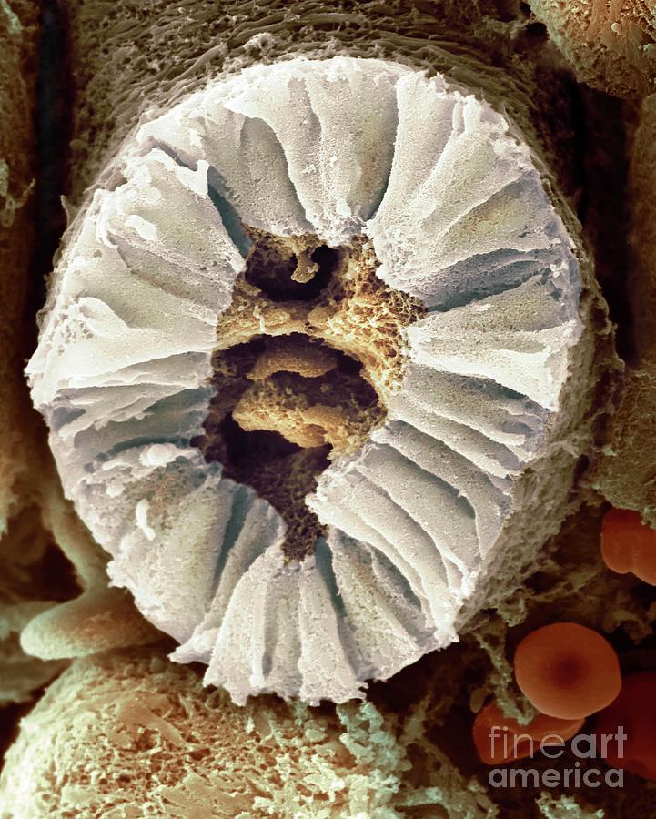 Human Kidney Nephron #1 Photograph by Dennis Kunkel Microscopy/science Photo Library