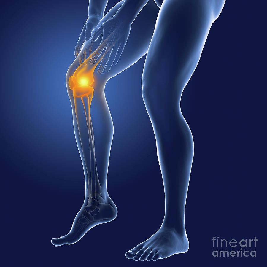 Human Knee Pain Photograph by Kateryna Kon/science Photo Library | Pixels