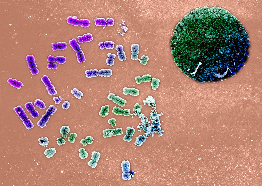 Human Male Chromosomes, Sem #1 Photograph by Biophoto Associates