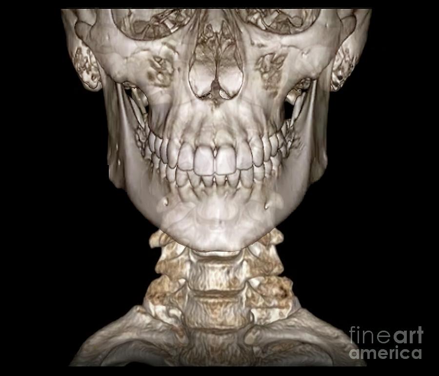 Human skull bones - Stock Image - C019/8342 - Science Photo Library