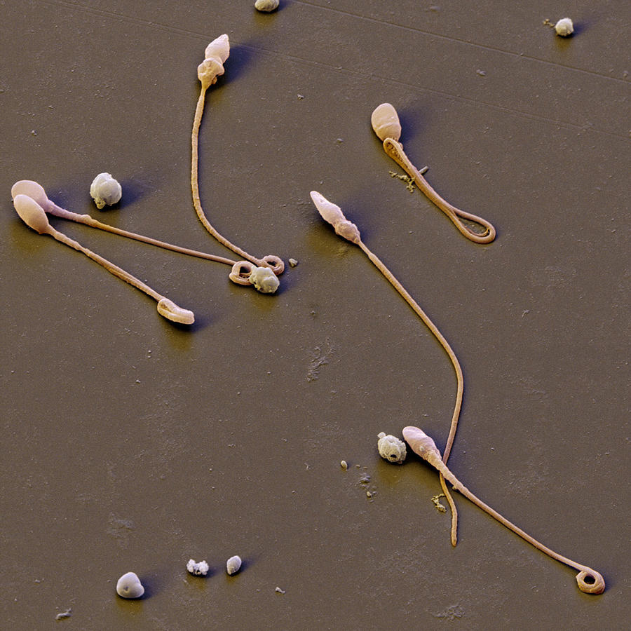 Human Sperm Cells #1 Photograph by Meckes/ottawa