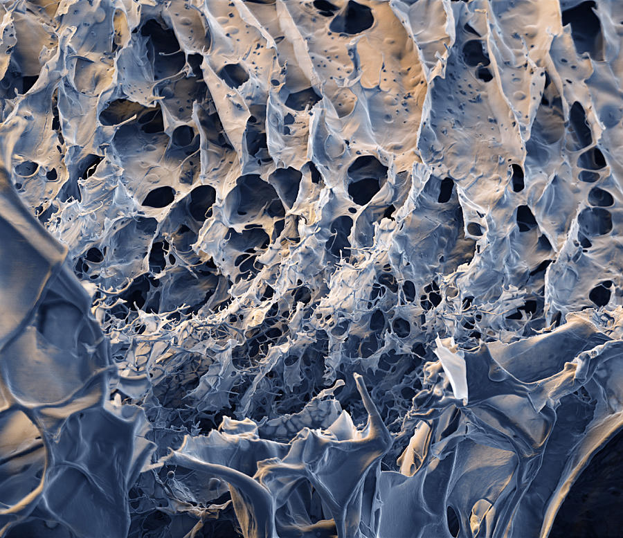 Hydrogel Of Synthetic Spider Silk, Sem #1 Photograph by Meckes/ottawa