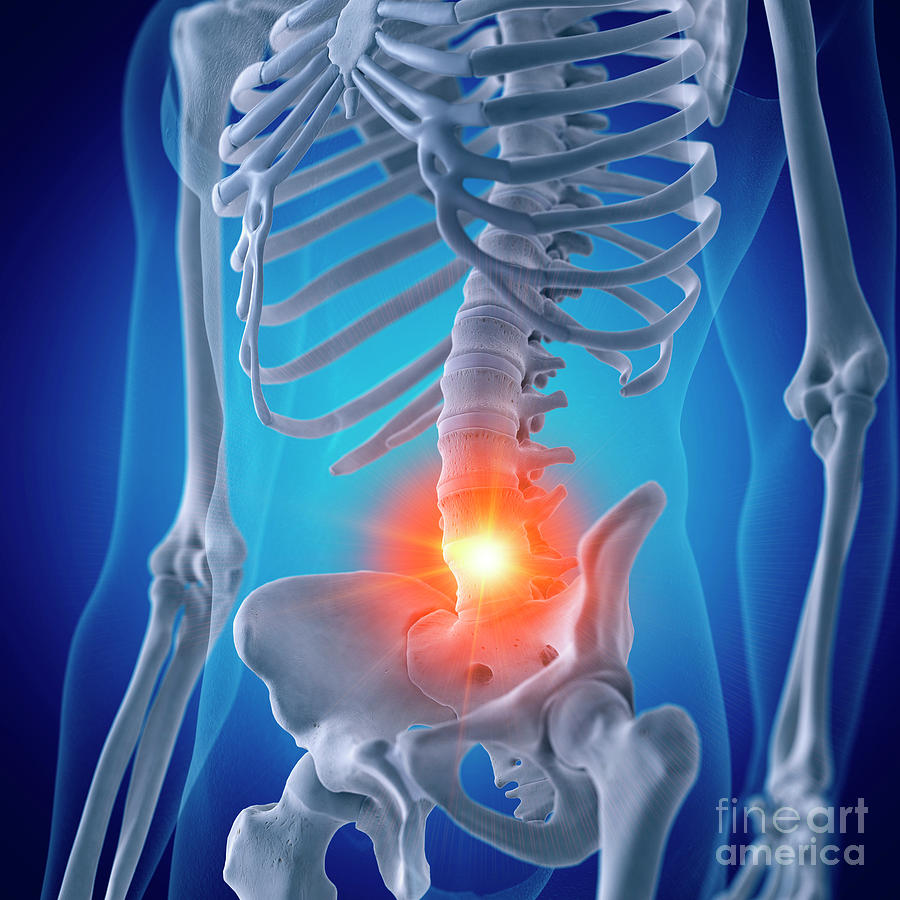 Illustration Of A Painful Lumbar Spine Photograph by Sebastian ...