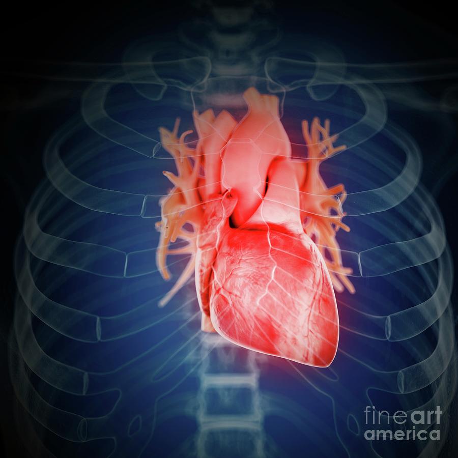 Illustration Of An Inflamed Heart Photograph by Sebastian Kaulitzki ...