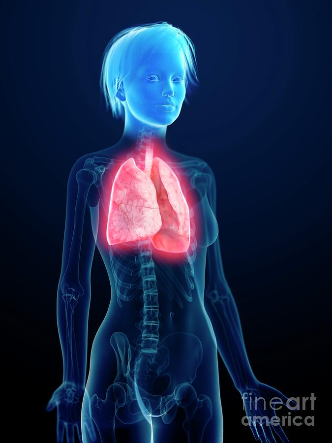 3d Photograph - Illustration Of An Inflamed Lung #1 by Sebastian Kaulitzki/science Photo Library