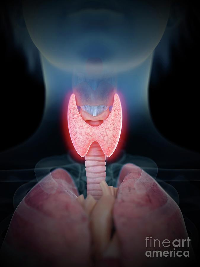 Illustration Of An Inflamed Thyroid Gland #1 Photograph by Sebastian ...