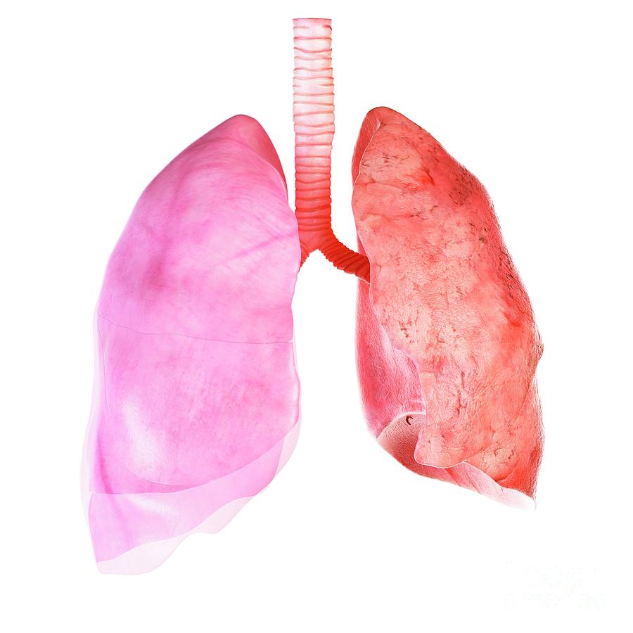 Illustration Of The Lung And Pleura Photograph by Sebastian Kaulitzki ...