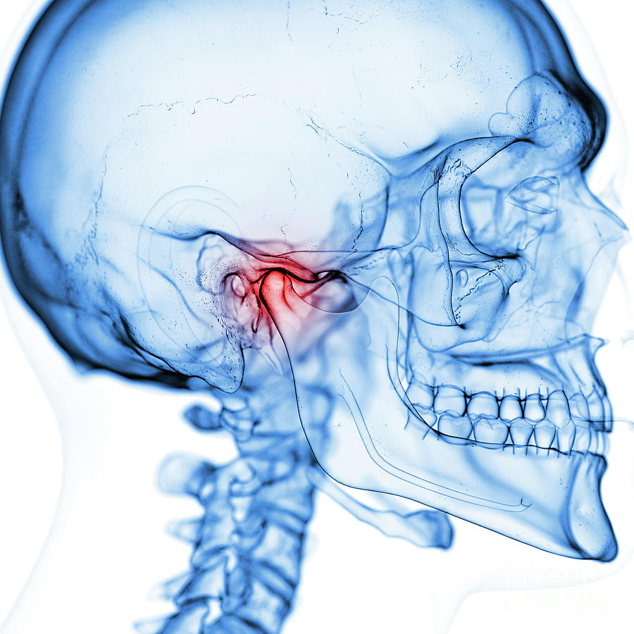 Illustration Of The Temporomandibular Joint 1 Photograph By Sebastian Kaulitzki Science Photo