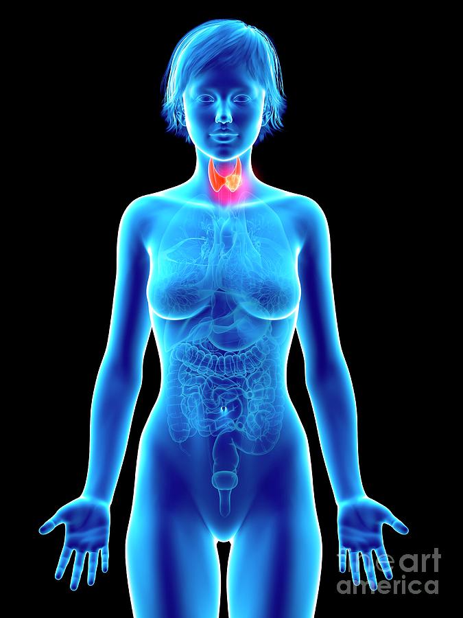 3d Photograph - Illustration Of Thyroid Gland Cancer #1 by Sebastian Kaulitzki/science Photo Library