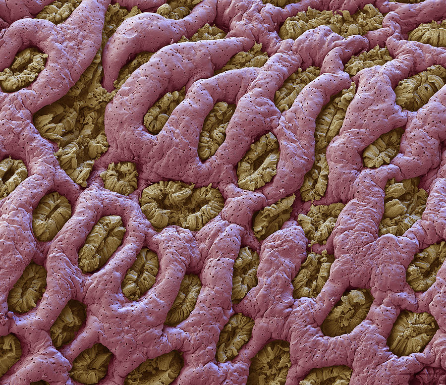 Intestinal Surface Showing Crypts, Sem Photograph by Eye Of Science ...