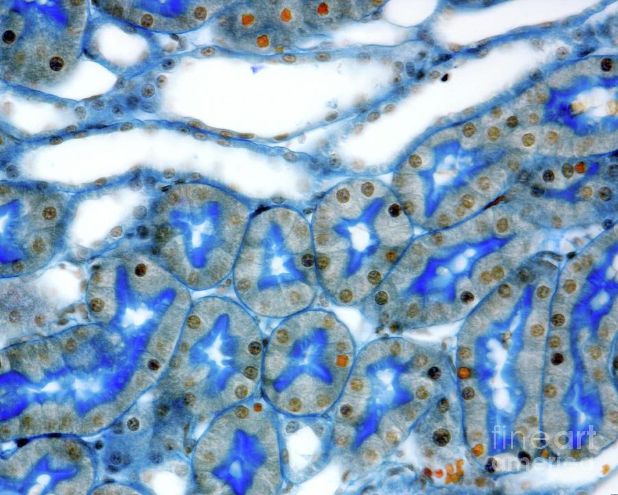 Kidney Convoluted Tubules #1 Photograph by Jose Calvo/science Photo Library