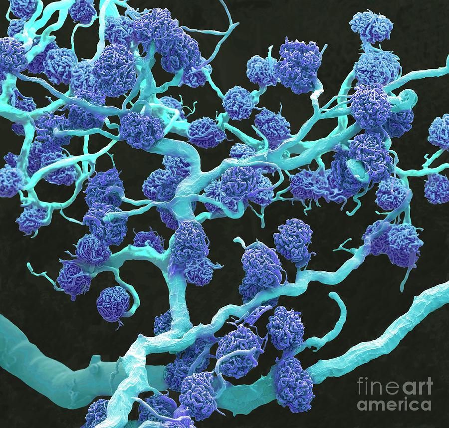 Kidney Glomeruli Photograph by Steve Gschmeissner/science Photo Library ...