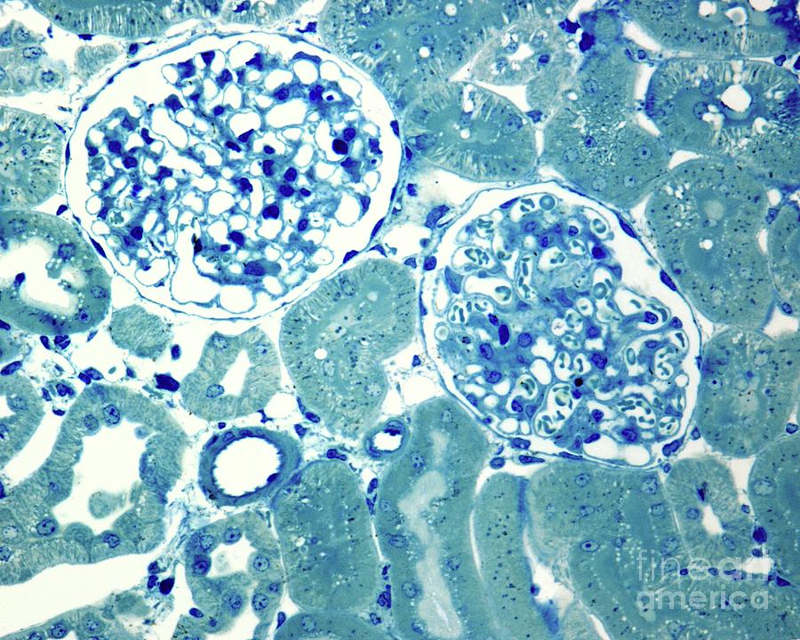 Kidney Glomerulus #1 Photograph by Jose Calvo / Science Photo Library