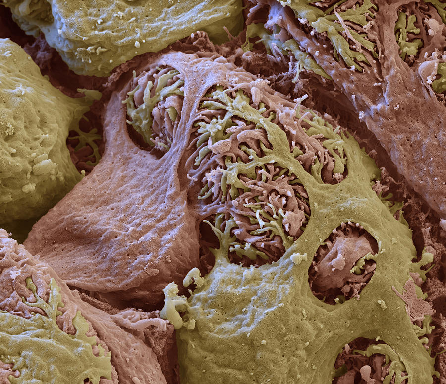 Kidney Glomerulus, Sem #1 Photograph by Oliver Meckes EYE OF SCIENCE