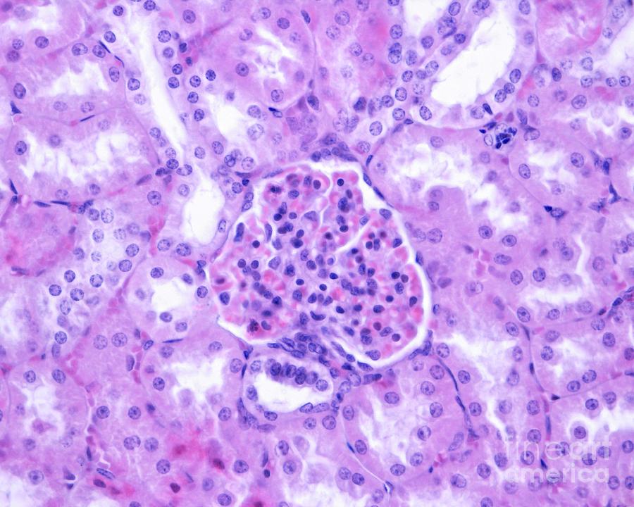 Kidney Macula Densa #1 Photograph by Jose Calvo/science Photo Library