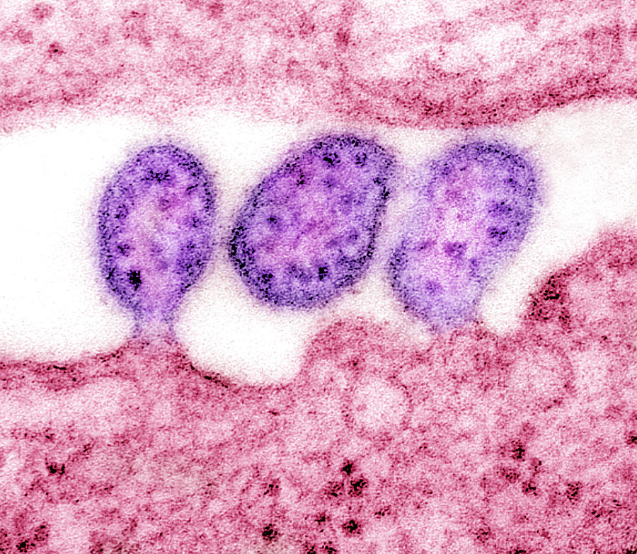 Lassa Virus, Tem #1 Photograph by Science Source