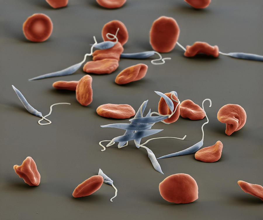 Leishmaniasis And Red Blood Cells, Sem #1 Photograph by Meckes/ottawa