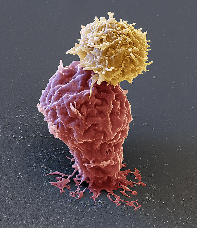 Cancer Photograph - Leukemia Cell With Car T-cell, Sem #1 by Oliver Meckes EYE OF SCIENCE
