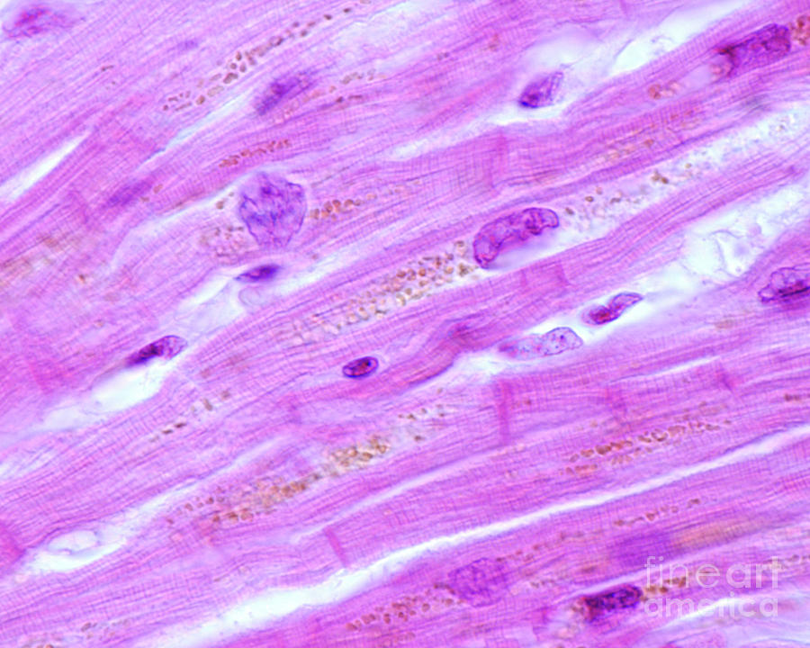 Lipofuscin In Heart Muscle Cells Photograph by Jose Calvo / Science ...