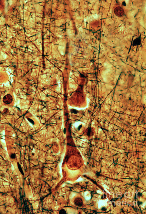 Lipofuscin In Pyramidal Neuron #1 Photograph by Jose Calvo / Science Photo Library