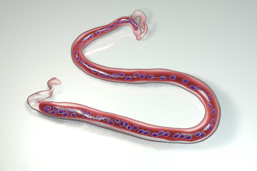 Loa Loa Parasitic Worm Photograph by Kateryna Kon/science Photo Library ...