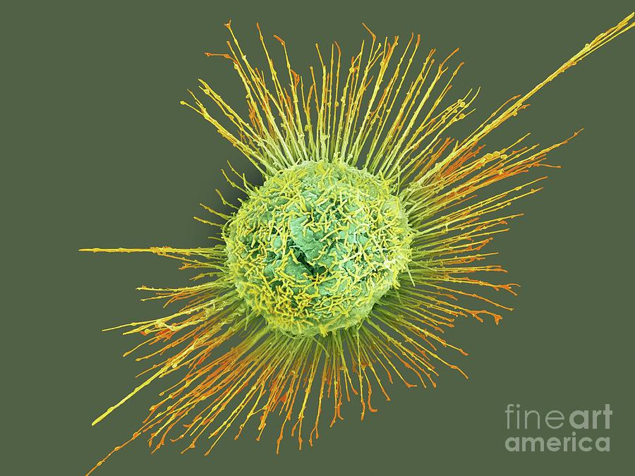 Lung Cell Infected With H1n1 Flu Virus #1 Photograph by Science Photo Library