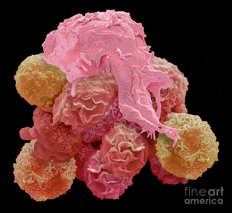 Macrophage And Cancer Cell Photograph By Steve Gschmeissner Science Photo Library Pixels