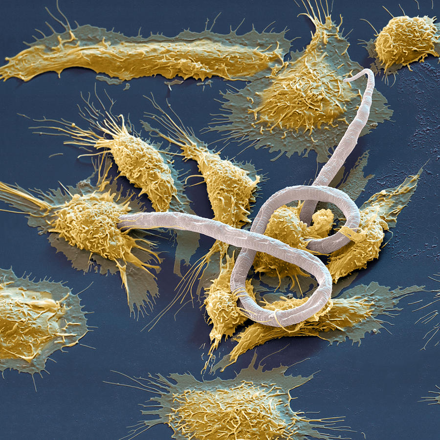 Macrophages Killing A Microfilaria #1 Photograph by Meckes/ottawa