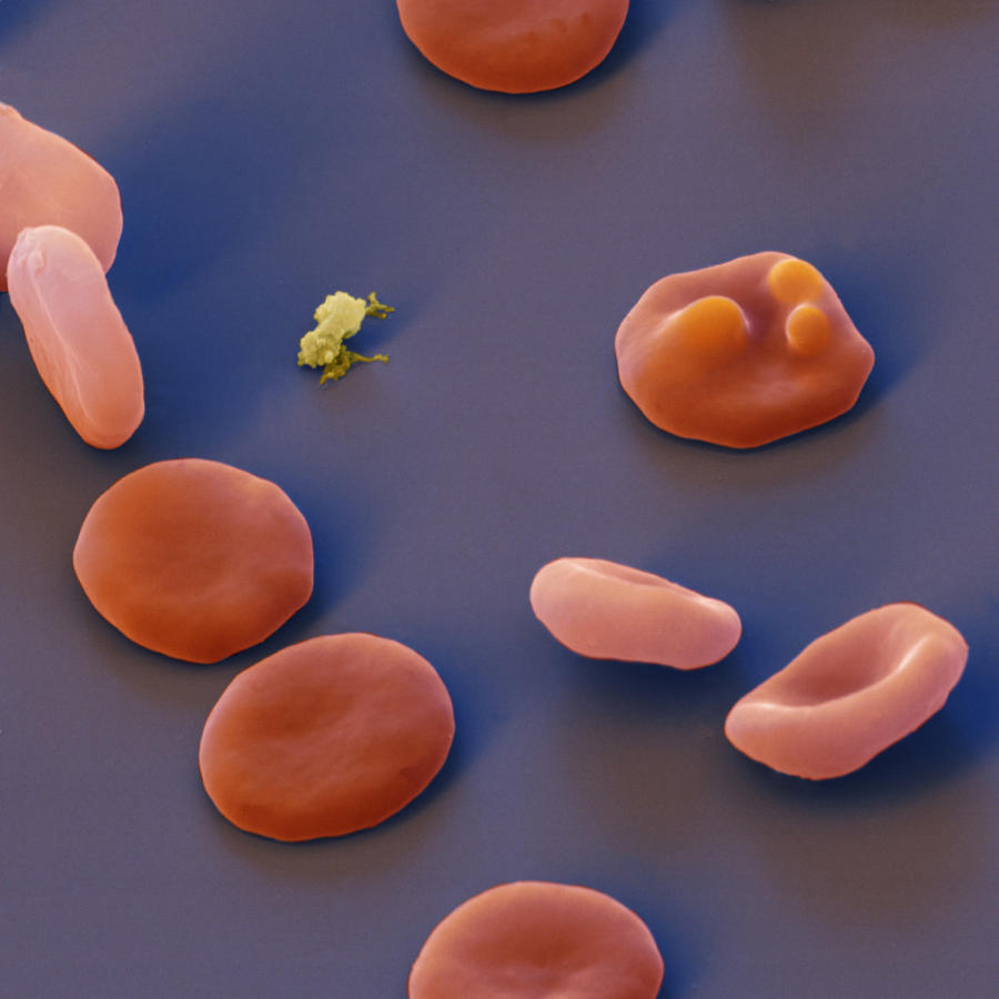 Malarial Parasites #1 Photograph by Meckes/ottawa