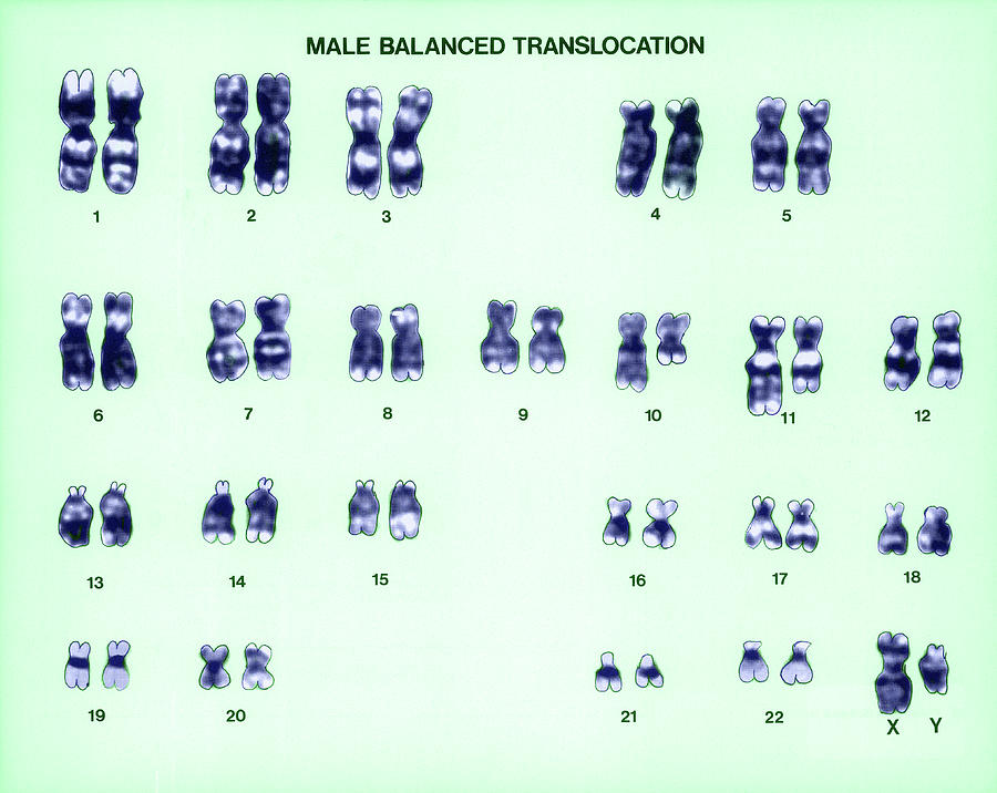 Male Balanced Translocation Karyotype #1 Photograph by Biophoto Associates