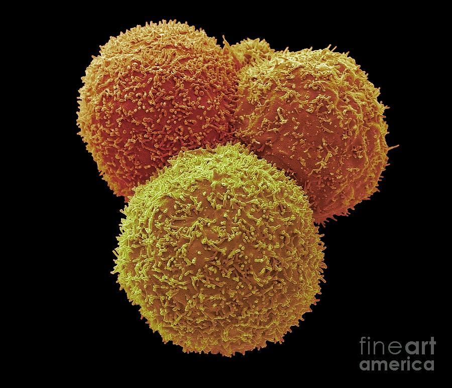 Mammalian Cells Photograph by Steve Gschmeissner/science Photo Library