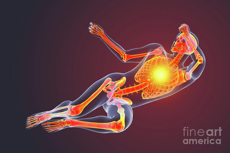 Man In Pain #1 Photograph by Science Photo Library Man In Pain #1 Photograph by Science Photo Library
