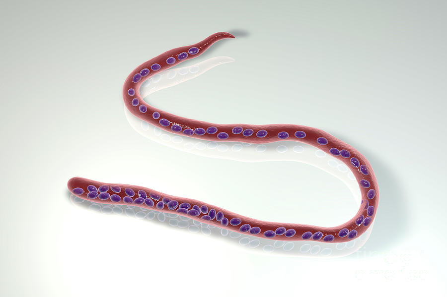 Condition Photograph - Mansonella Ozzardi Parasitic Worm #1 by Kateryna Kon/science Photo Library
