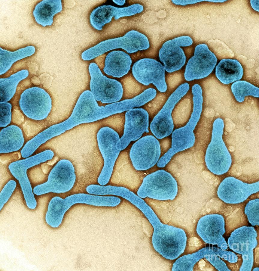 Marburg Virus Photograph by Niaid/science Photo Library - Fine Art America