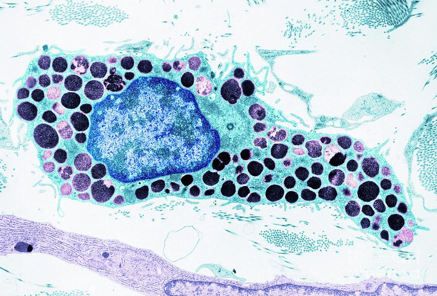 Mast Cell Photograph by Secchi-lecaque/roussel-uclaf/cnri/science Photo Library/science Photo Library