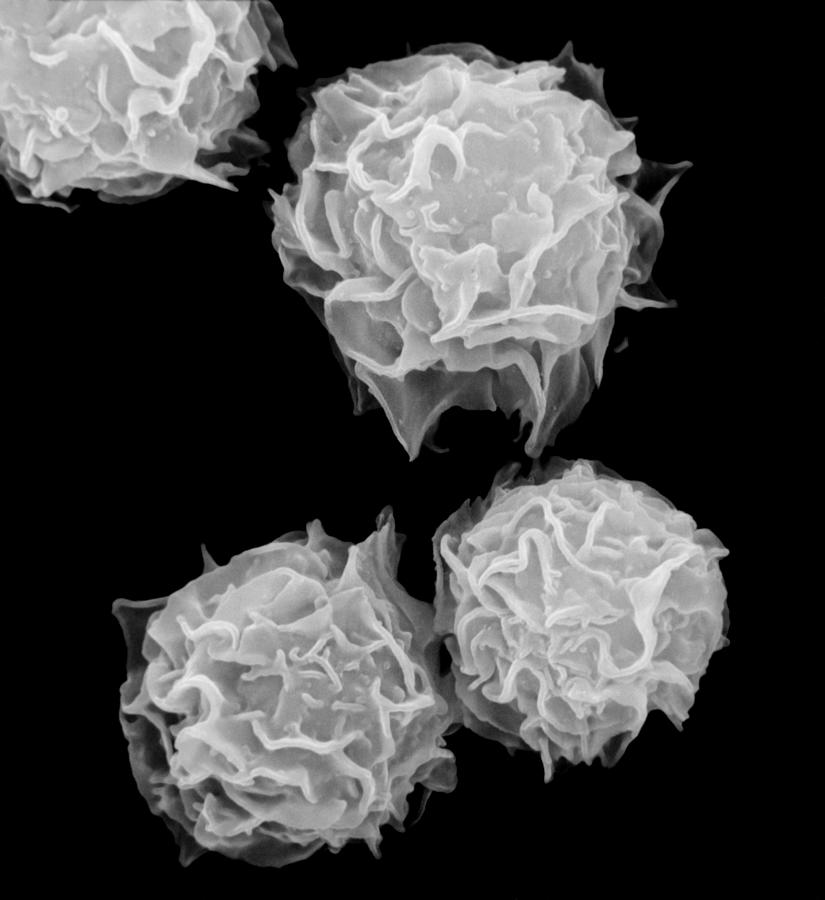 Mast Cells, Sem #1 Photograph by Stem Jems
